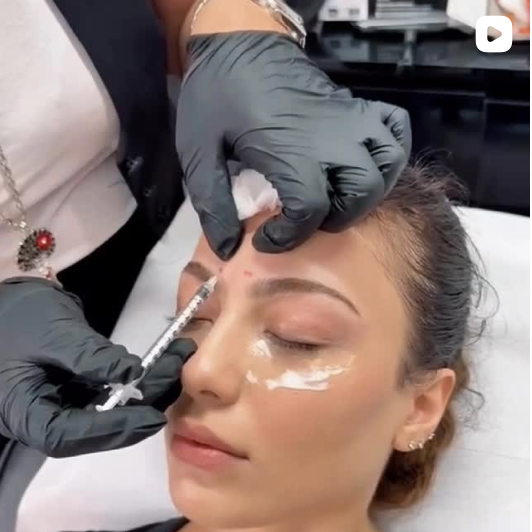 Rafaela Thomé treatment video Instagram post